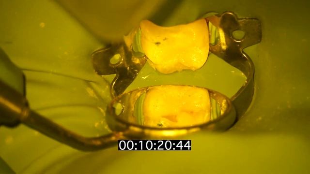 Direct Resto class 1 смотреть онлайн