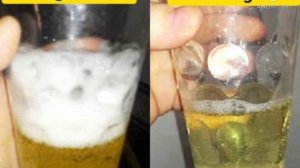 HOMILADORLIKNI UY SHAROITIDA ANIQLASH # ХОМИЛАДОРЛИКНИ УЙ ШАРОИТИДА АНИКЛАШ