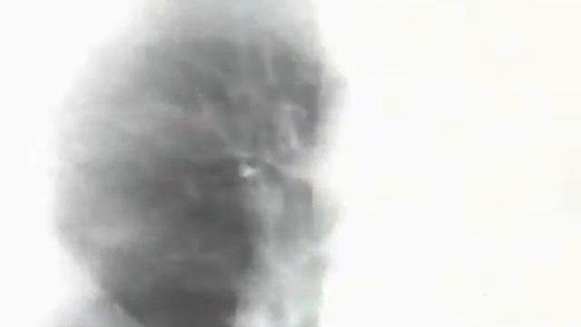 Biologia - Fisiologia - O sistema circulatório смотреть онлайн