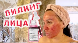 ПИЛИНГ ЛИЦА