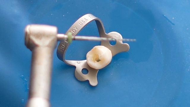 Root Canal Procedure | What and How the Root Canal Treatment are Done. смотреть онлайн