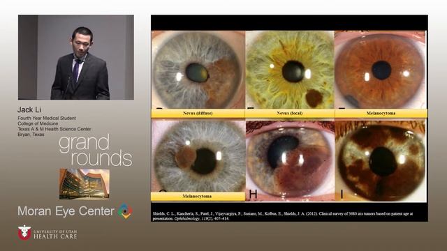 Dark Side of the Iris смотреть онлайн