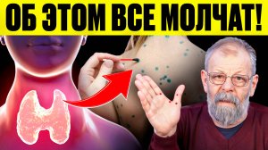ЭТИ мифы о щитовидке превращают человека в вечного пациента