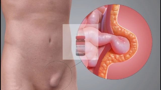 Nux Vomica Homeopathy Medicine|Nux Vomica 30|Nux Vomica 200 |Use, Symptoms| নাক্স ভোমিকা ঔষুধ|