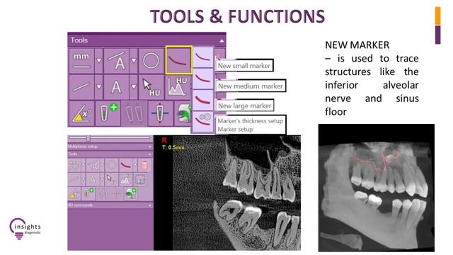 Insights Diagnostic - iRYS Software Tutorial - Tools and Functions смотреть онлайн