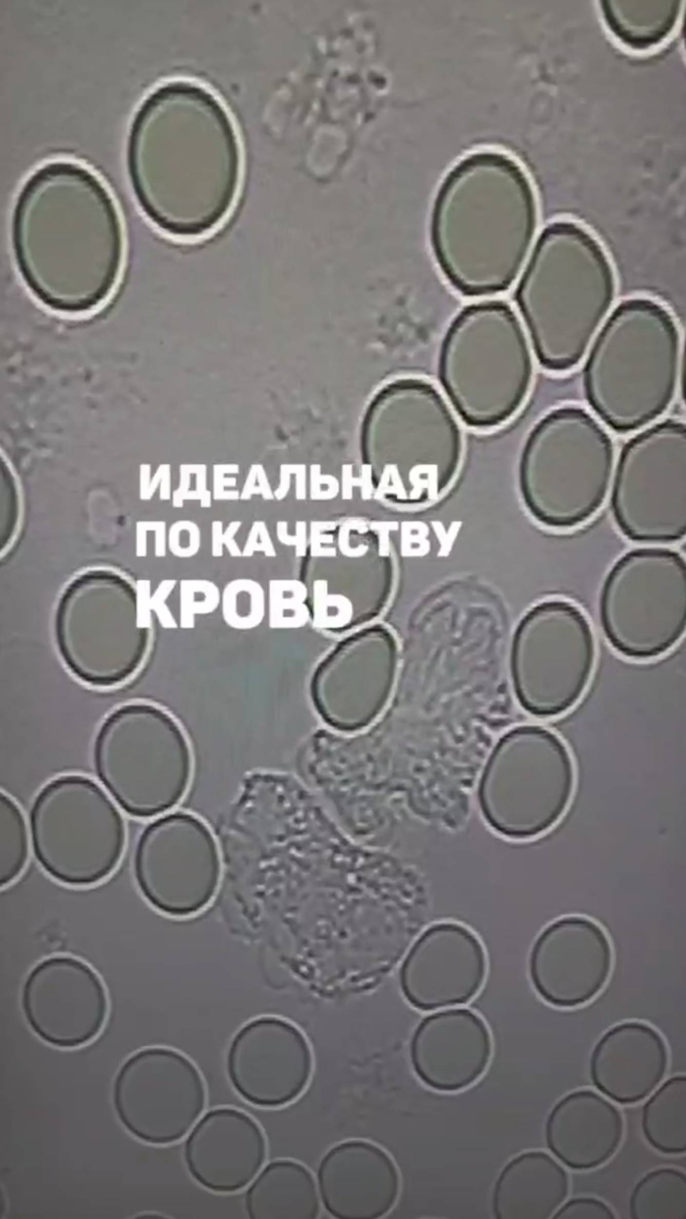 Так выглядит идеальная по качеству кровь. Алена Братишко смотреть онлайн