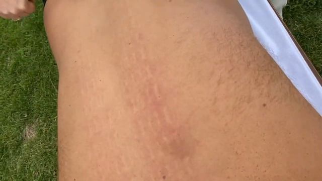 Роули для Спины. Разработка Madesto-Lab. Мадеротерапия 