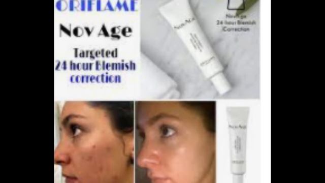 NovAge 24 hours targeted blemish correcting gel\adult acne treatment\dark spots treatment\deep scar смотреть онлайн