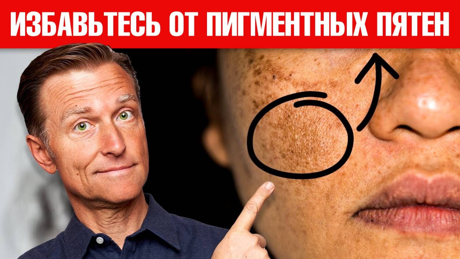 Лучшее средство от пигментных пятен на лице!🙌 смотреть онлайн