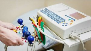 Проведение ЭКГ