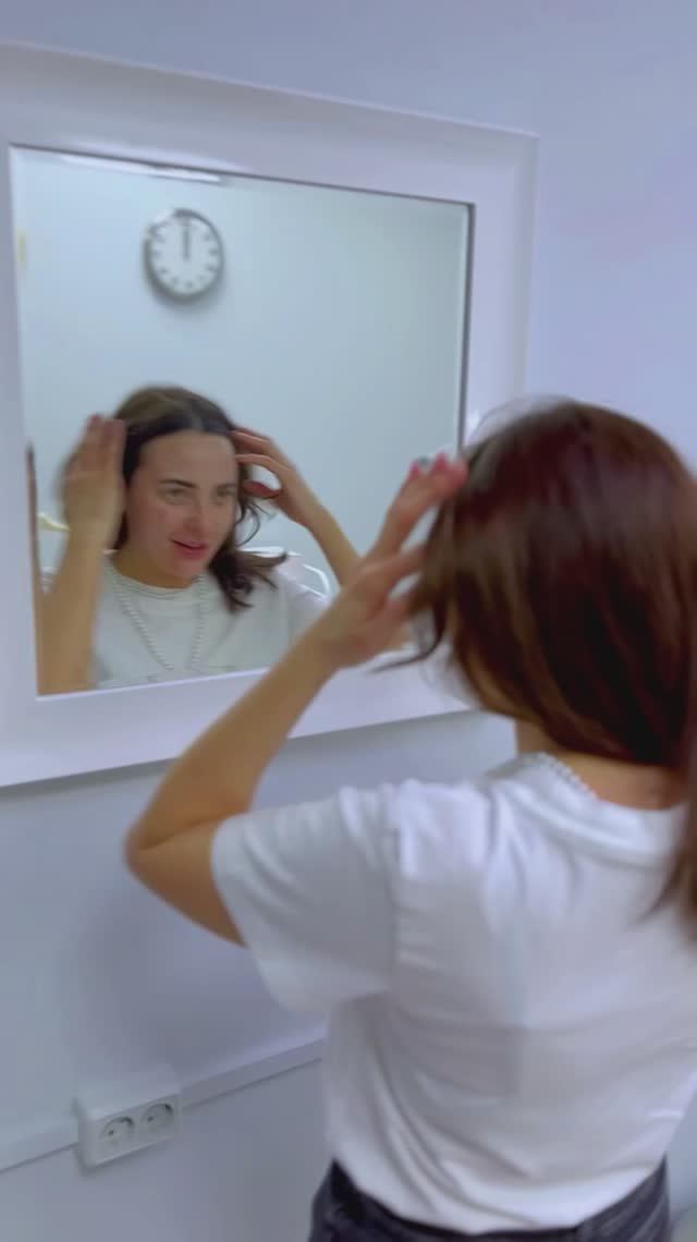 Останутся ли следы и синяки после Биоревитализации? смотреть онлайн