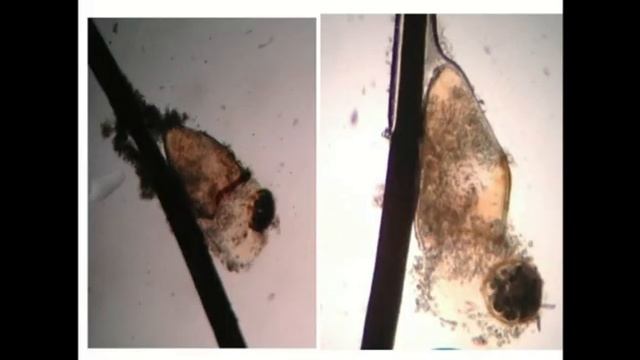 Bugging bugs of the Eyelids смотреть онлайн