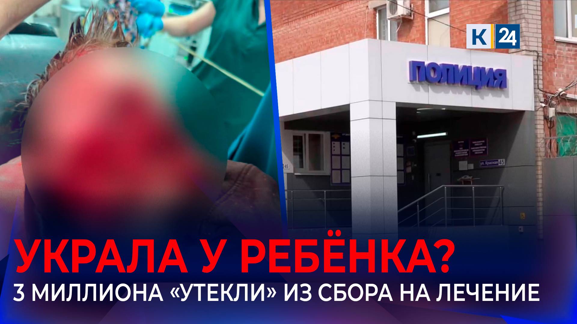 В краже 3 млн рублей экс-жену обвинил отец мальчика с откушенным лицом из Сочи смотреть онлайн