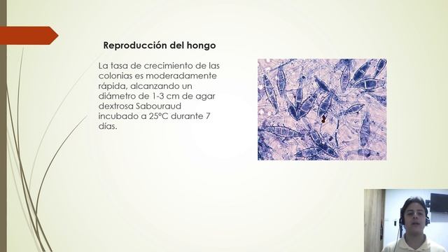 Microsporum gallinae смотреть онлайн
