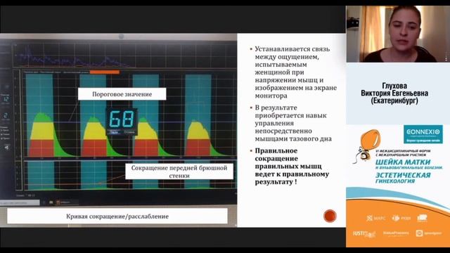 Нехирургические технологии в коррекции пролапса_ на подиуме БОС