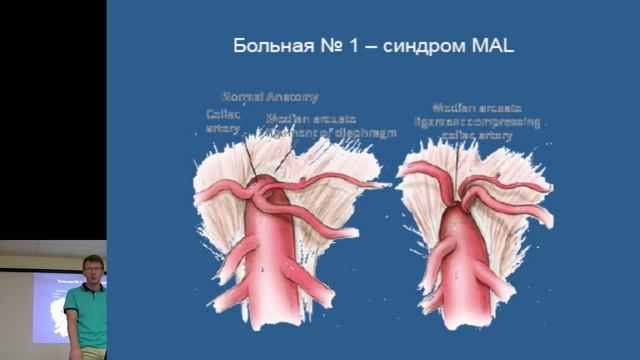 Остановка кровообращения в операционной. Часть 2. Леонид Кривский