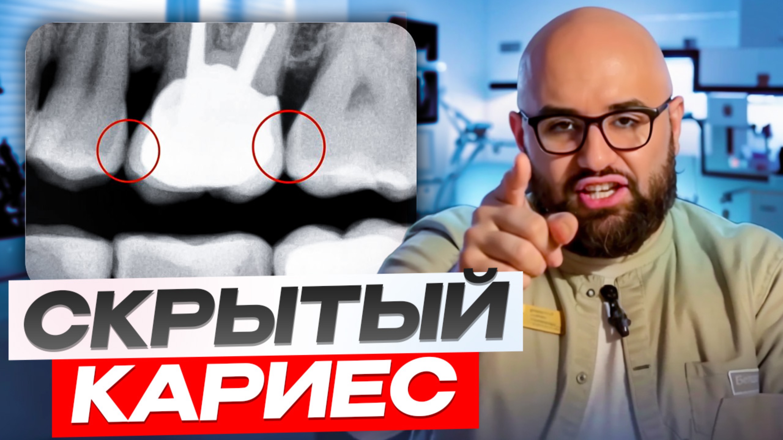 Скрытый кариес!
