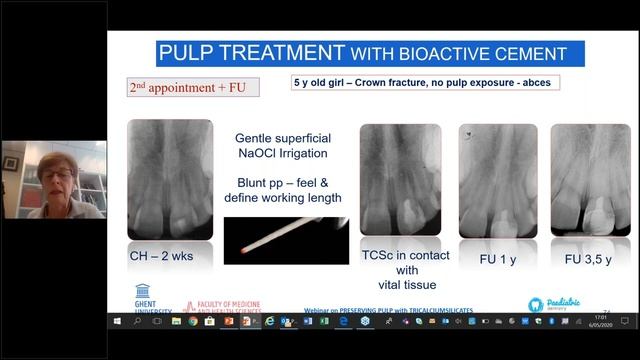 Preserving pulp with tricalcium silicates Septodont & Ghent University webinar смотреть онлайн