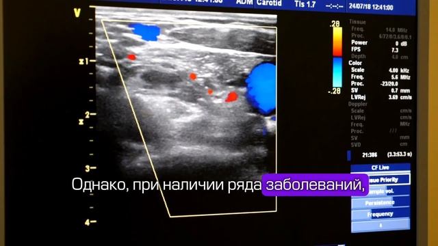 Правильный диагноз начинается с правильного обследования: советы врача УЗИ - диагностики. смотреть онлайн