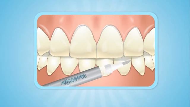BleachBright KeepBright Pen смотреть онлайн