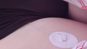 как поменять канюлю в Акку Чек Комбо | инсулиновая помпа | диабет 1 типа