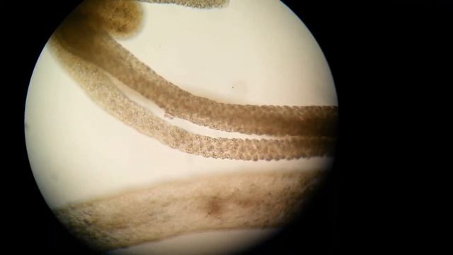Hydra and its parasite Trichodina (Part 2)