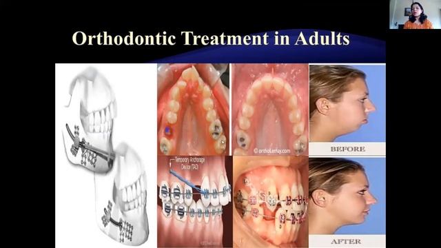 Dental Sleep Medicine – Treatment options for OSA смотреть онлайн