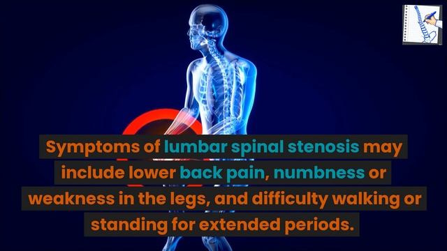 What is lumbar spinal stenosis? смотреть онлайн