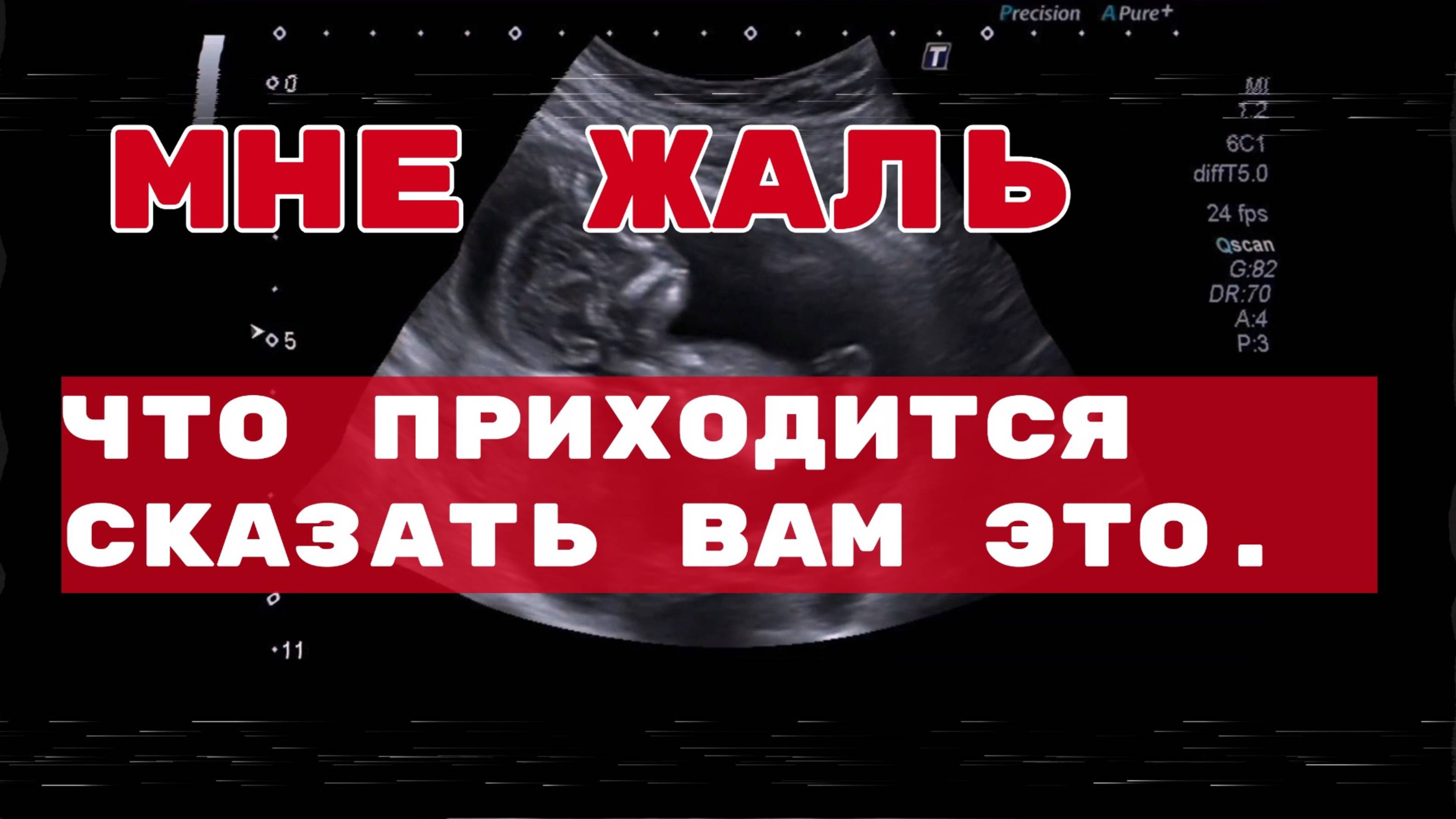 Каждый день — выбор: Как сохранить здоровье и не скатиться вниз смотреть онлайн