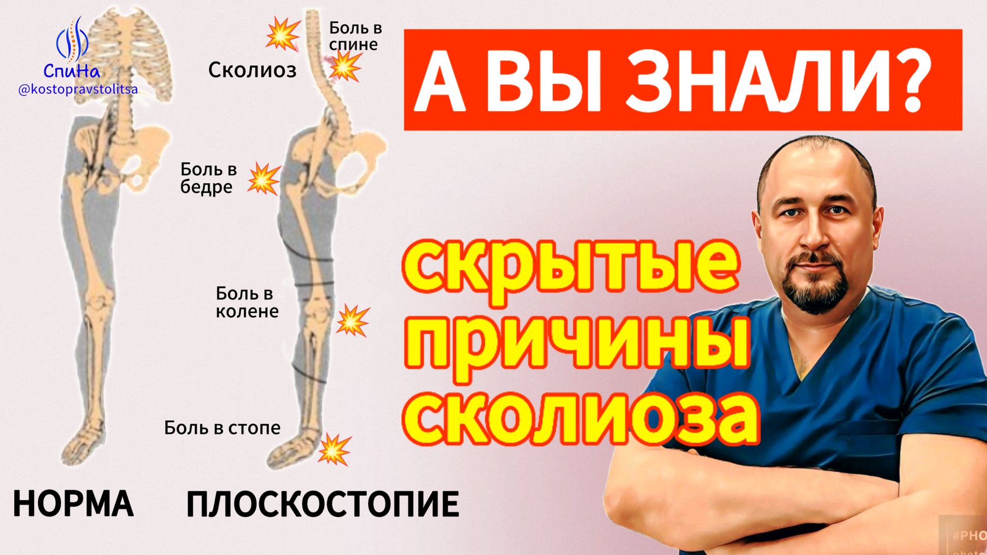 Скрытые причины сколиоза #костоправмосква #здоровьеспины #каклечить #чтоделать #правка #сколиоз смотреть онлайн