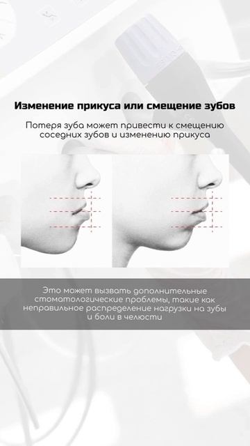 Как понять, что вам нужно протезирование