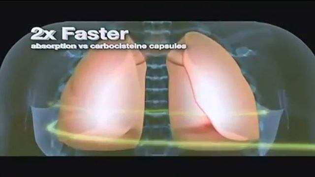 Robitussin Liquigel Philippines TVC смотреть онлайн