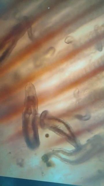 DANGEROUS FISH PARASITES:DACTYLOGYROSIS|GILL FLUKE|ROHU FISH|LABEO ROHITA|KILLS FISH|FISH FARMING смотреть онлайн