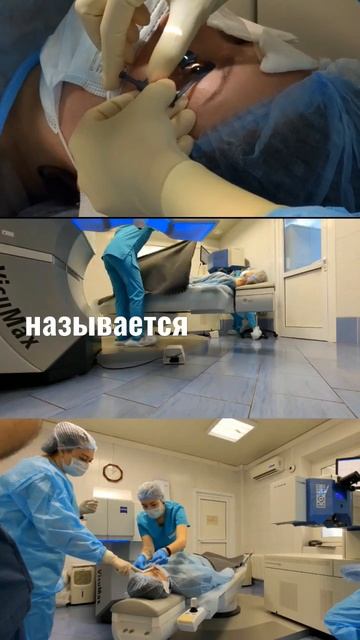 лазер топчик #зрение #лазернаякоррекциязрения #близорукость #клиникасфера смотреть онлайн