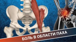 БОЛЬ В ОБЛАСТИ ПАХА