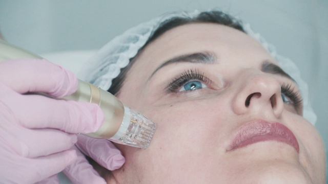 Микроигольчатый RF - ЛИФТИНГ смотреть онлайн