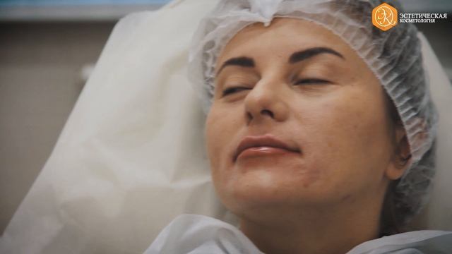 Контурная пластика смотреть онлайн