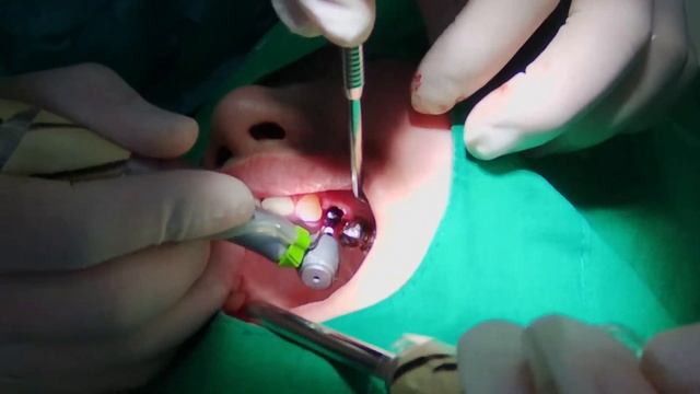 #24 immediate implant смотреть онлайн