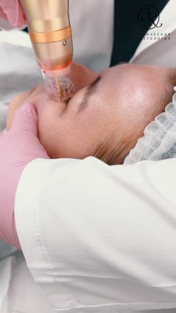 Микроигольчатый RF - ЛИФТИНГ Reels смотреть онлайн