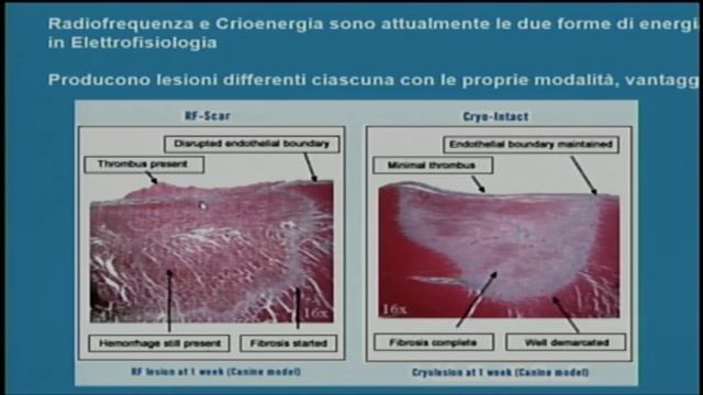 Senatore Calipso 20160618 смотреть онлайн