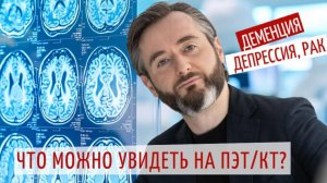 Случайные находки на ПЭТ: как сканирование спасает жизни?