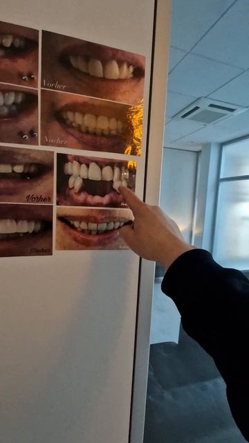 У меня разболелся Зуб... #Germany #ludwigsburg #zahnarzt смотреть онлайн