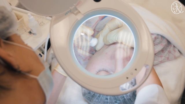 Микродермобразия смотреть онлайн