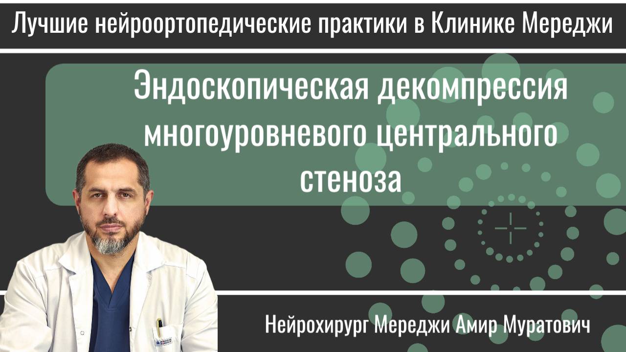 Эндоскопическая декомпрессия многоуровневого центрального стеноза. смотреть онлайн