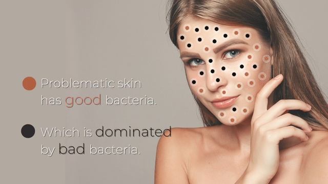 Bree Probiotic Skincare - Explained смотреть онлайн