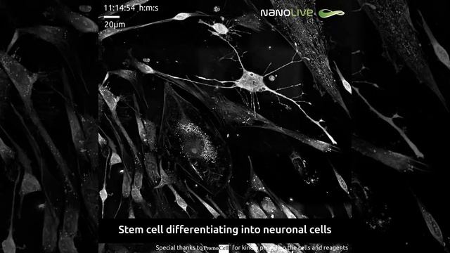 Stem cell differentiating into neuronal cells смотреть онлайн