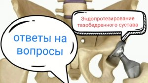 ответы на вопросы
