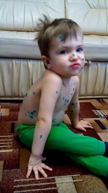 ветрянка смотреть онлайн