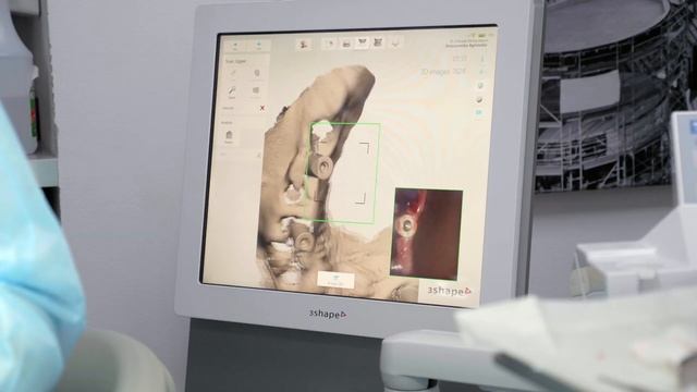 Fully digital full-arch treatment. Sobczak® Concept with Straumann® Pro Arch смотреть онлайн