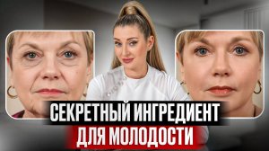 Это чудо-средство подтянет кожу БЕЗ операции?! Стоит ли колоть полимолочную кислоту?